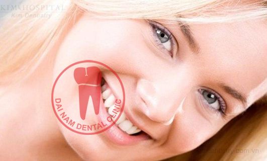 Niềng răng sứ thẩm mỹ có ảnh hưởng đến mức độ chắc khỏe của răng